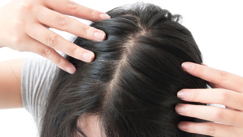 Stop your Hair Loss and Regrow Hair Naturally