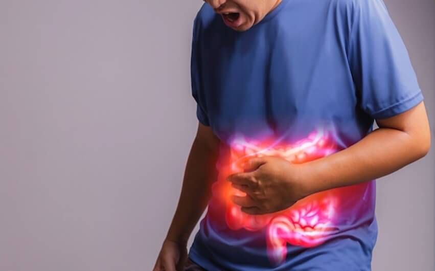 Gastroesophageal Reflux Disease